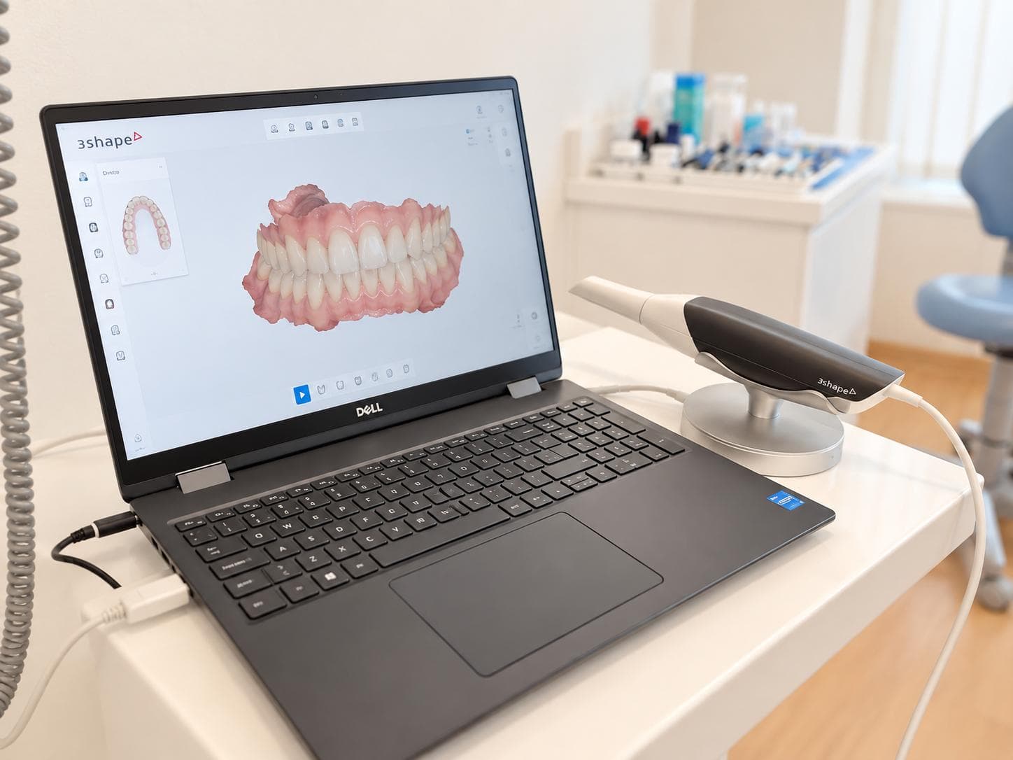 Escáner intraoral y planificación dental digital en Clínica Carbonell García